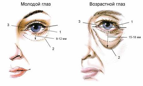 Возрастные изменения кожи вокруг глаз