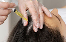 Плазмолифтинг волос – третья процедура бесплатно!