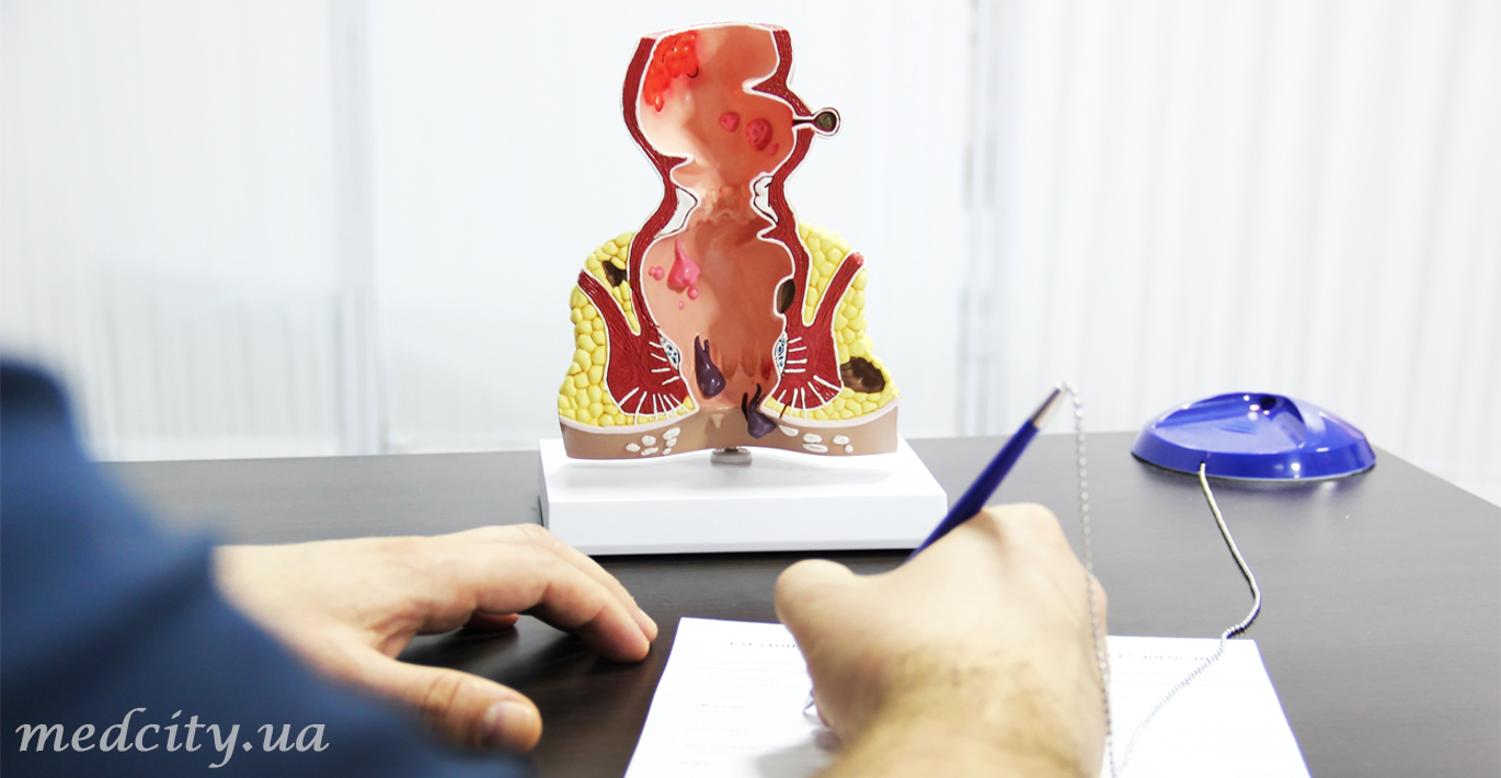 При каких симптомах необходимо обращаться к проктологу?