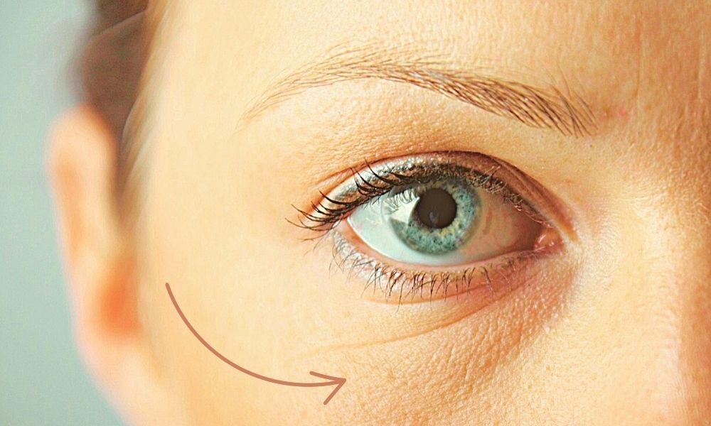 Малярные мешки, причины появления и методы избавления