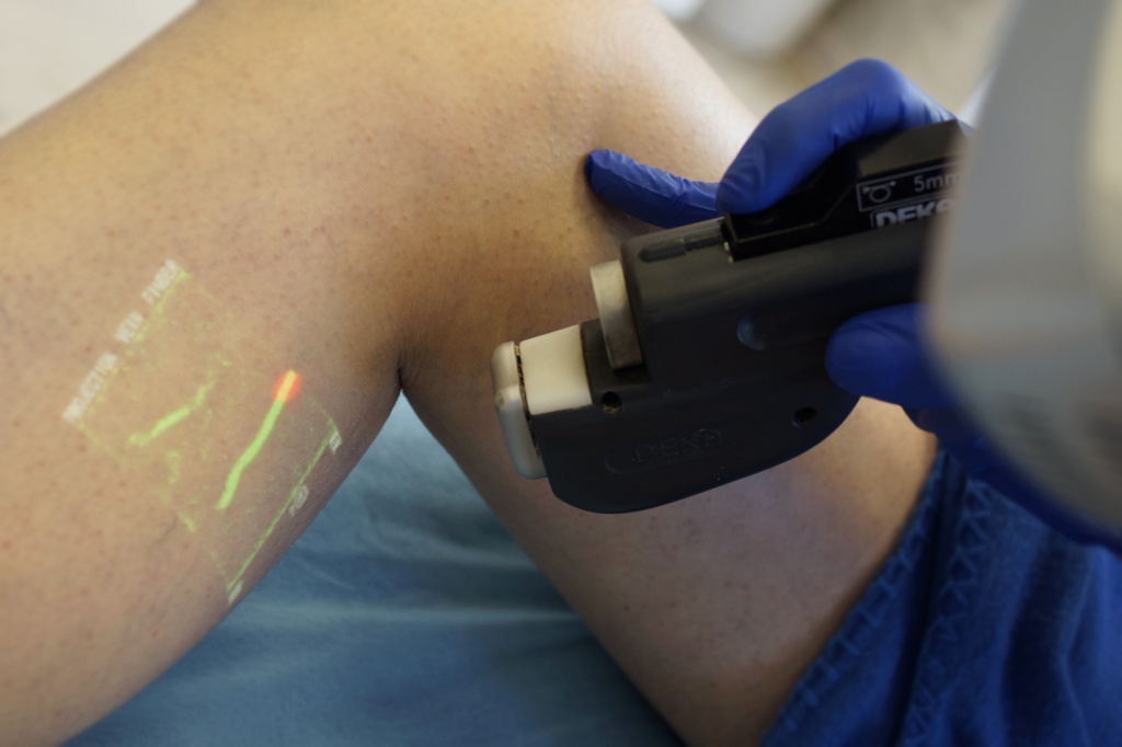 Лікування варикозу Київ