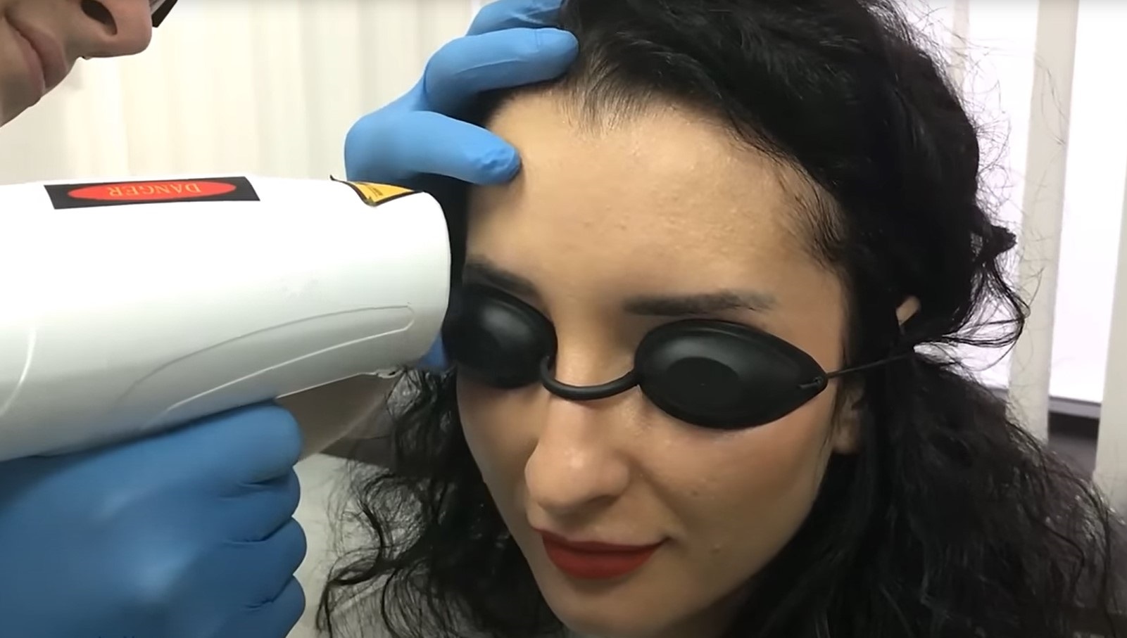 Удаление татуажа бровей лазером, фото до и после