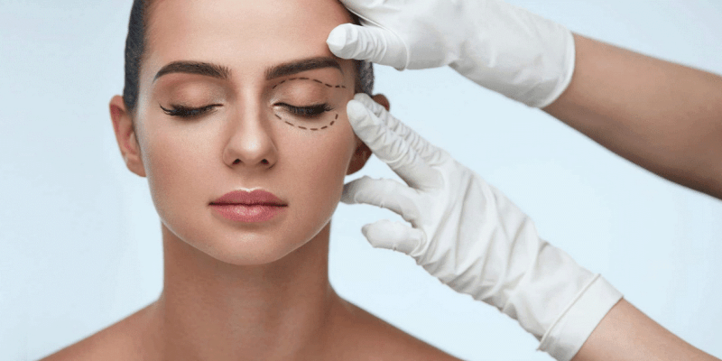 Блефаропластика: до и после