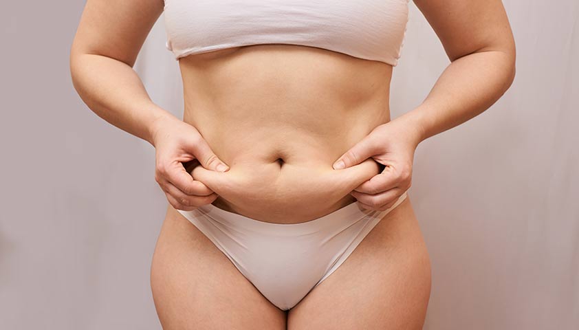 Как быстро убрать целлюлит с живота?