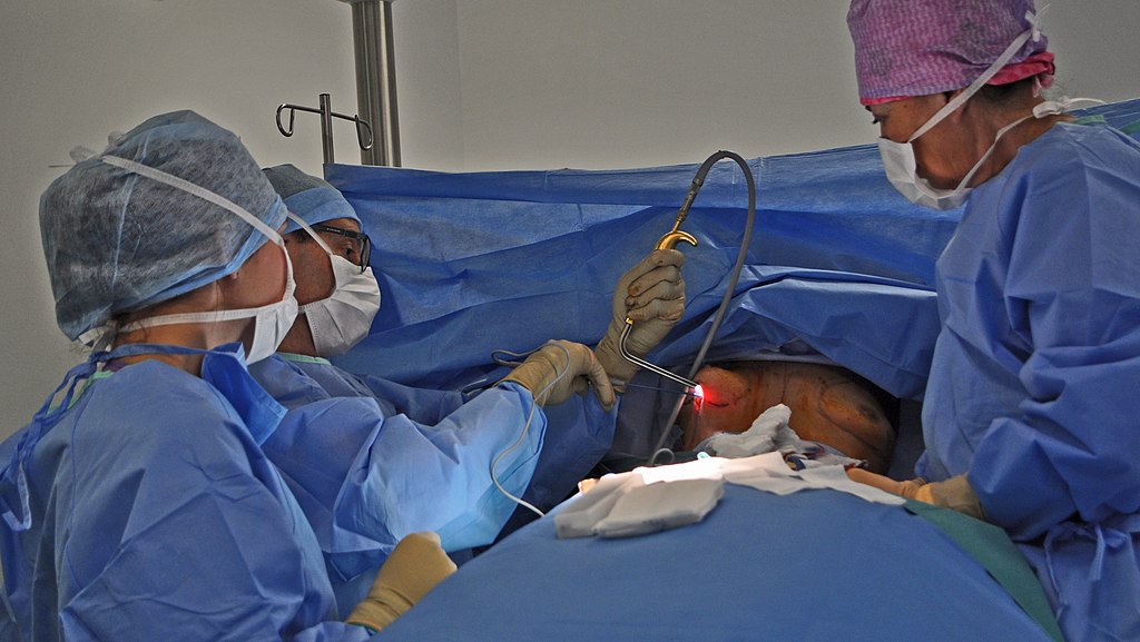 Сколько стоит увеличить грудь?