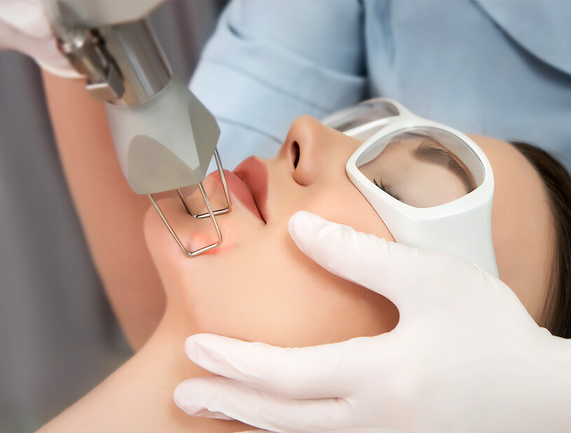 Лазер в дерматологии