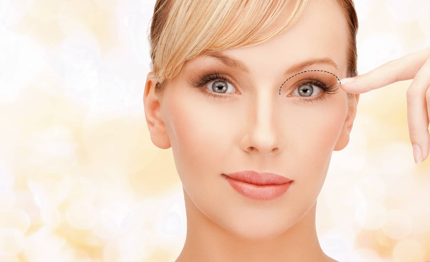 Как убрать нависшее веко