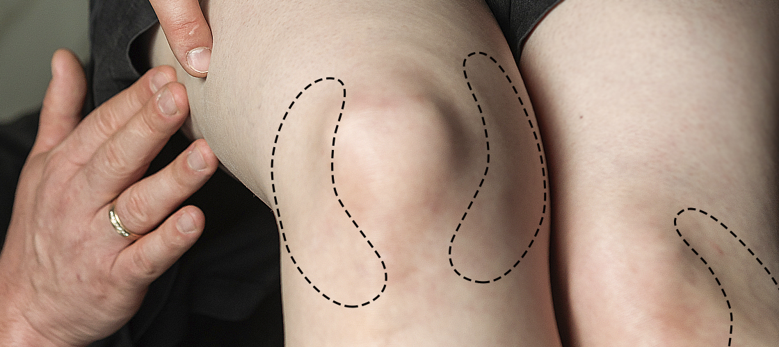 Пластическая хирургия в Киев