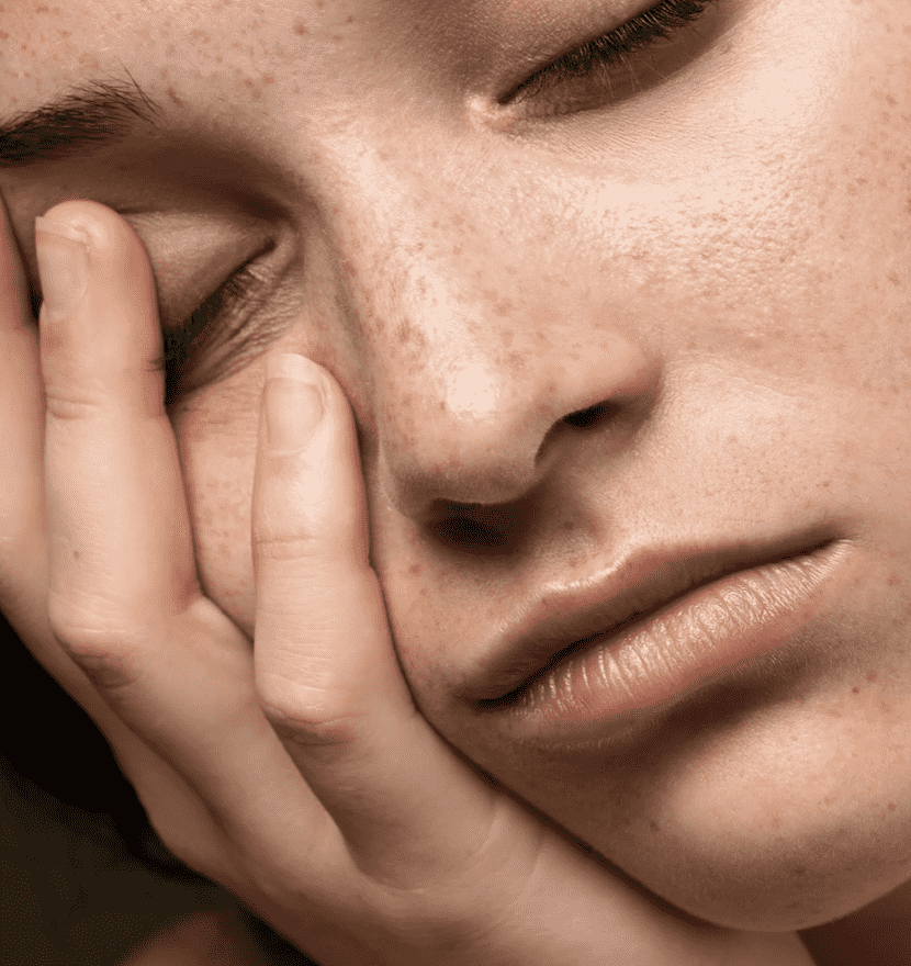 Подкожные прыщи: причины и лечение