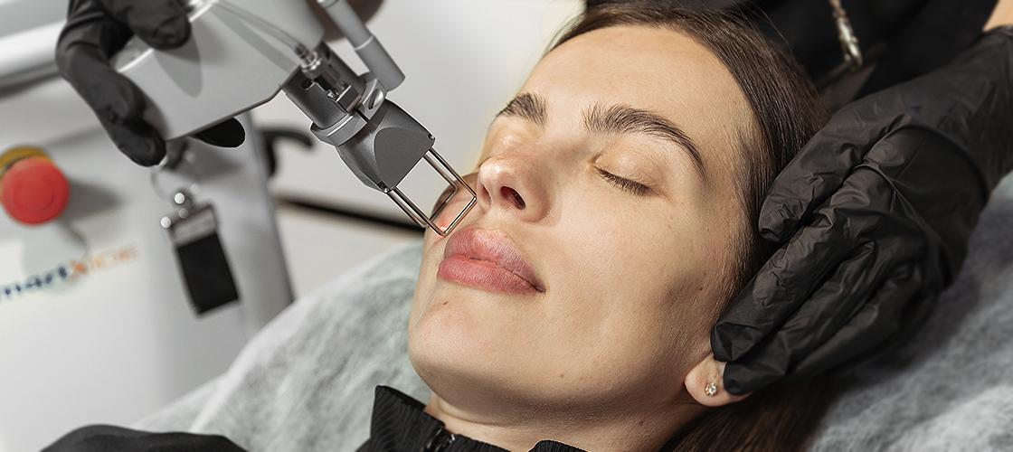 шлифовка лица киев