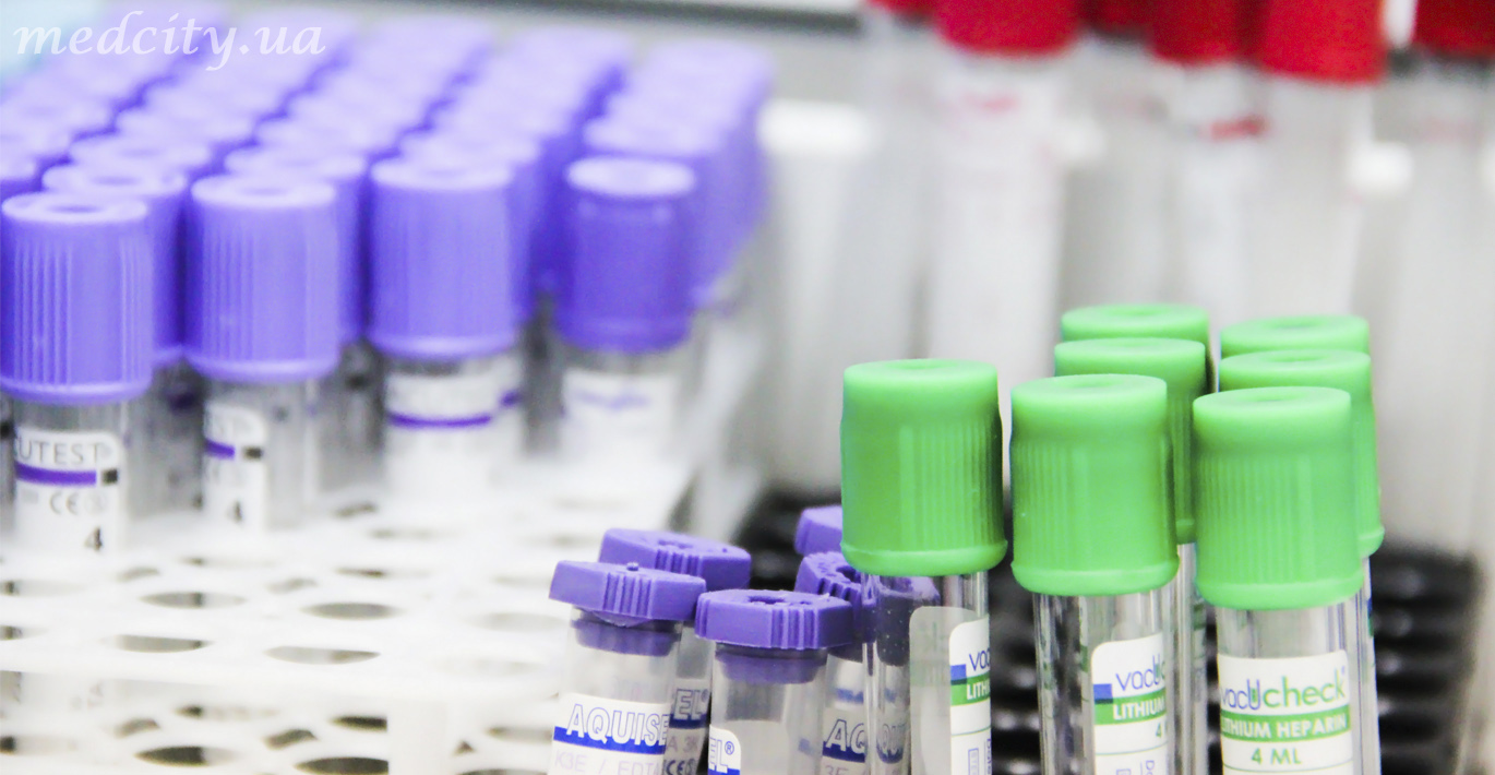 Правила подготовки к исследованиям крови