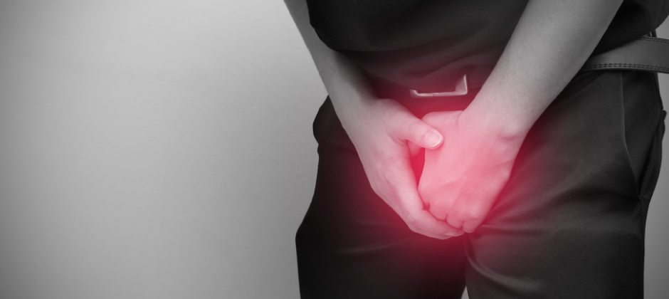 Варикоцеле фото