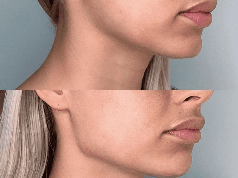 Углы Джоли – культовые черты идеального лица