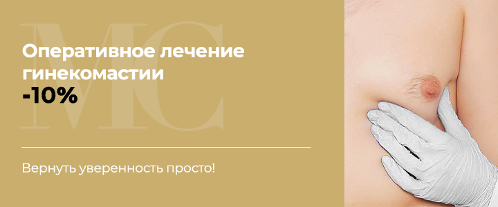 Оперативное лечении гинекомастии -10%