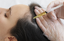 Плазмолифтинг волос: Первая процедура -25%