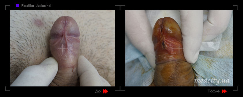 ������� �� ������� ����� - 4