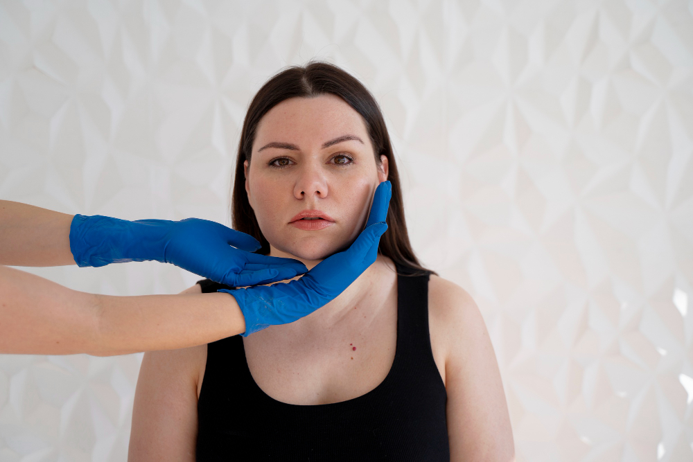 Липосакция щек