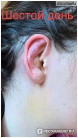 После операции