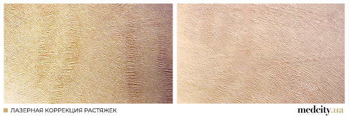 2 рос.png 2 рос.png