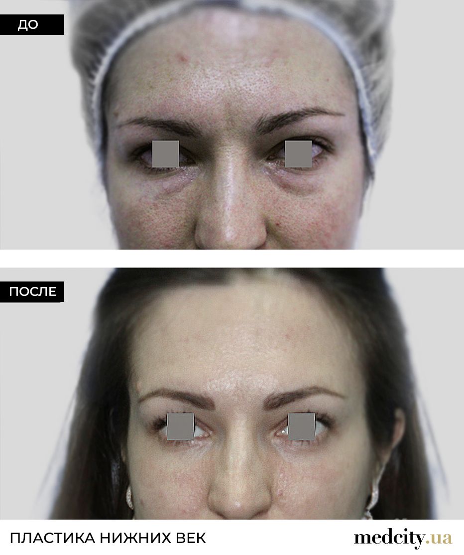 dz50ecllapm4r4nc6lneeckdwpyt2x6y.jpg dz50ecllapm4r4nc6lneeckdwpyt2x6y.jpg