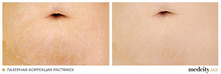 3 рос.png 3 рос.png