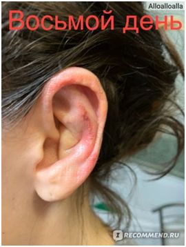 После операции