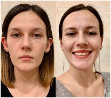 После операции