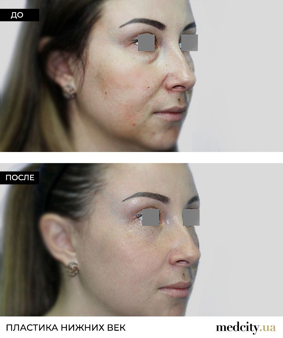 ndpuxeyep22cke3fkrbp7vetcqs7dsao.jpg ndpuxeyep22cke3fkrbp7vetcqs7dsao.jpg