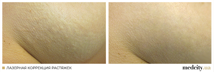 5 рос.png 5 рос.png