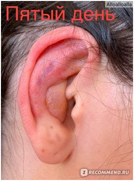 После операции