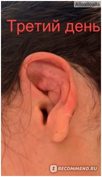 После операции