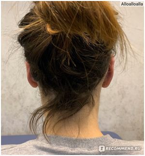 После операции