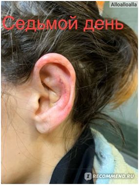 После операции