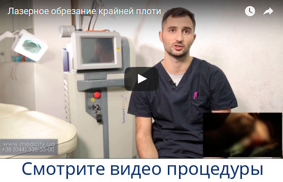 ����� ������� ����������� ��������� �� ���� ����� �����