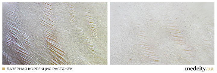 1 рос.png 1 рос.png