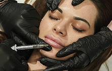 Контурная пластика