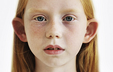 Отопластика