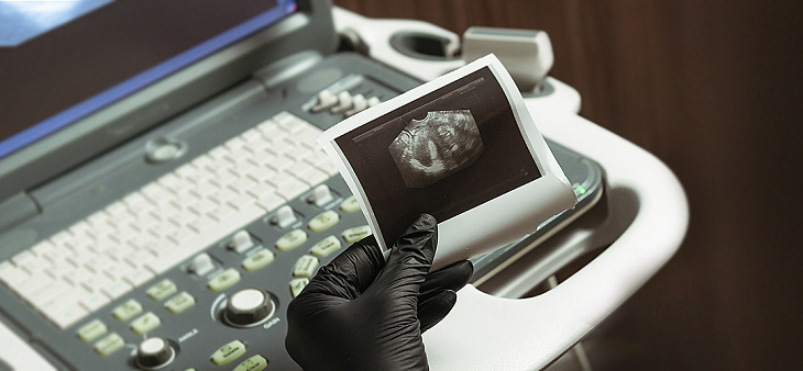 УЗИ диагностика 