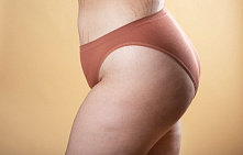 Можно ли полностью удалить растяжки на спине