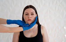 Липосакция щек