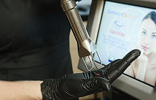 Лазерная фракционная шлифовка промежности