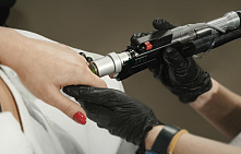 Лазерная эпиляция рук