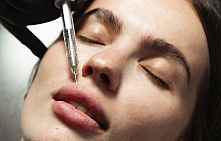 Увеличение губ