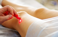 Удаление кондилом