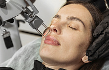 Лазерная шлифовка кожи лица		