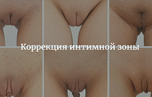 Реконструктивная хирургия в гинекологии ― вагинопластика и лабиопластика
