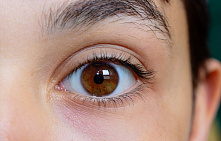 Кантопексия и кантопластика