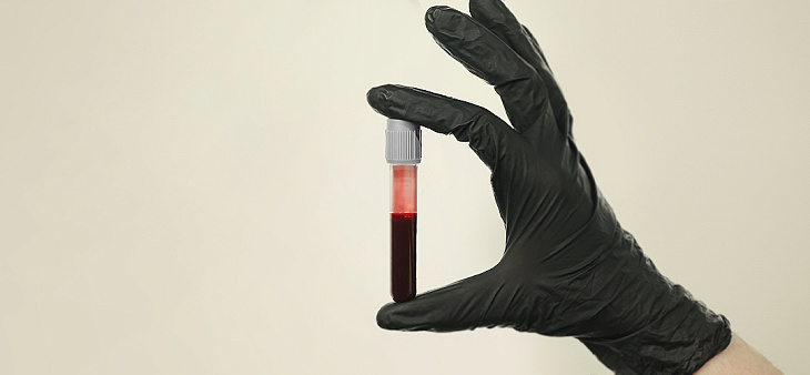 Лабораторная диагностика