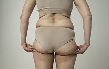 Как убрать «ушки-галифе» на бедрах